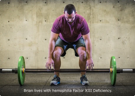 Brian, who lives with Factor 13 deficiency, is preparing to lift a barbell with weights
