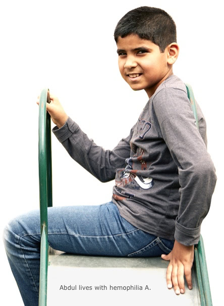 Profile view of Abdul, who lives with hemophilia A, sitting at the top of a slide, smiling and turned toward camera