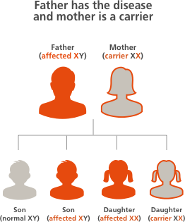 Changing Hemophilia illustration depicting the possibilities of children inheriting the hemophilia gene when the father has hemophilia and the mother is a carrier, with a 50 percent chance a son will have hemophilia, a 50 percent chance a daughter will have hemophilia, and a 50 percent chance a daughter will be a carrier 