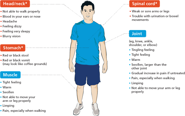 Changing Hemophilia illustration of a male with locations  of possible bleeds, including head and neck, stomach, muscle, spinal cord, and joint and symptoms including headache, red or brown urine, limping, and pain
