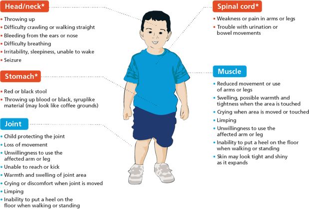 Changing Hemophilia illustration of a child with locations  of possible bleeds, including head and neck, stomach, muscle, spinal cord, and joint and symptoms including headache, red or brown urine, limping, and pain
